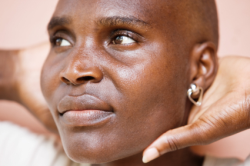 hair loss in black women
